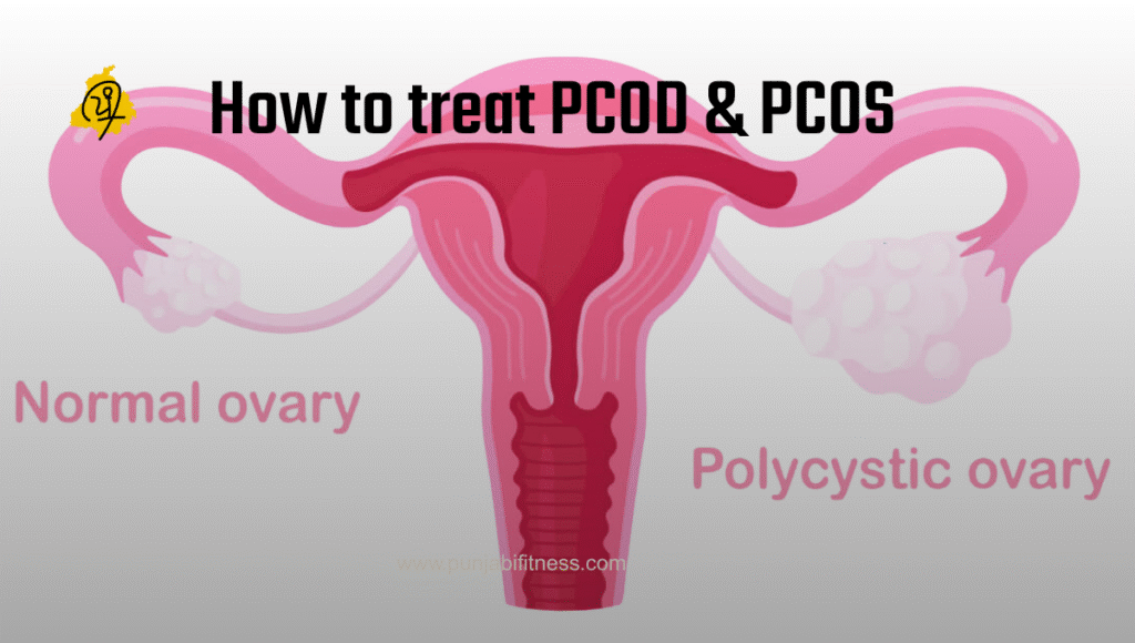 PCOD Friendly Lifestyle: What to Eat, How to Move, and What to Avoid